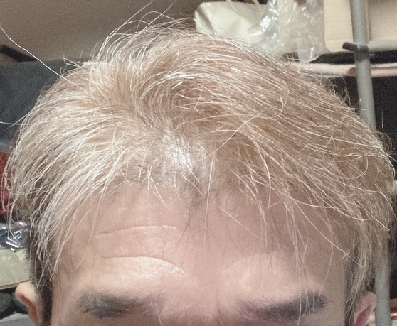 玉手箱を開けてしまいました。その②の画像